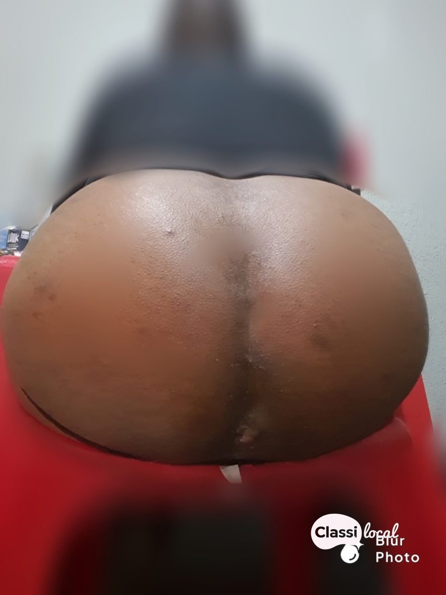 Bundona gulosa  — foto 2 de 3